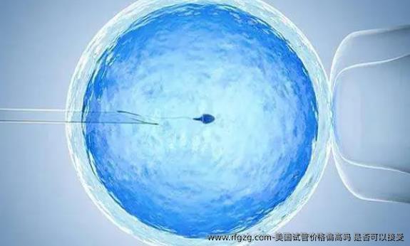 美国试管价格偏高吗 是否可以接受