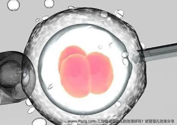 三胎做代孕的效果好吗？代孕效果分享