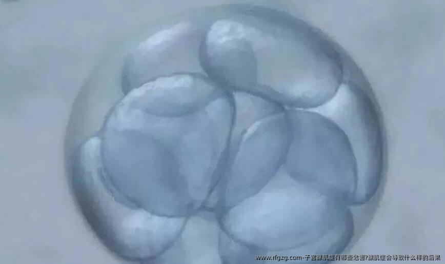 子宫腺肌症有哪些危害?腺肌症会导致什么样的后果