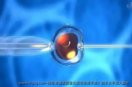 现在美国代孕成功率高不高？技术水平深入解析