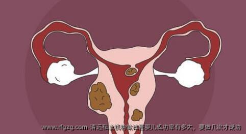 清远私立机构做代孕成功率有多大，要做几次才成功